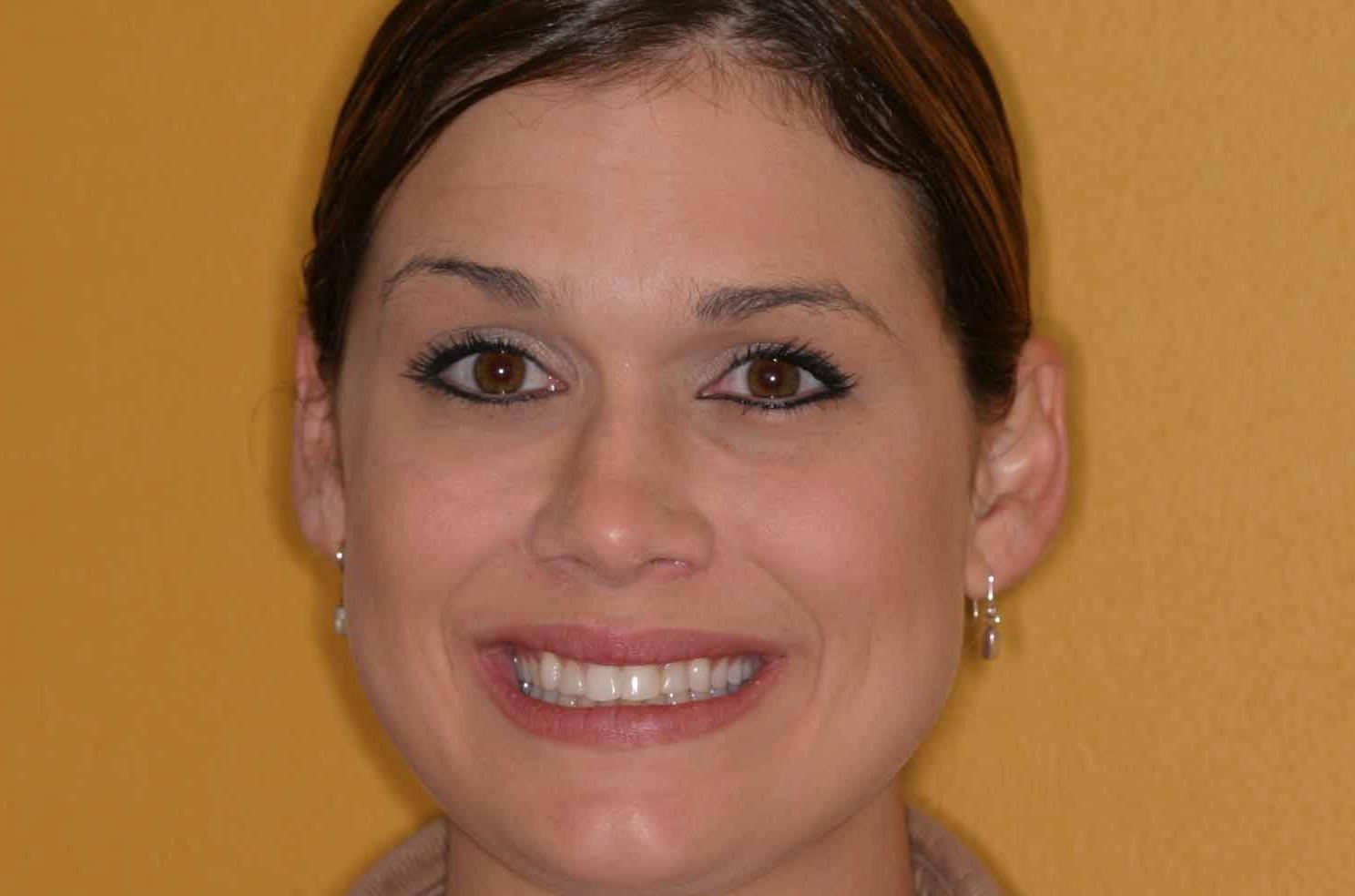 Cosmetic Dentist Fort Myers Cape Coral Naples FL